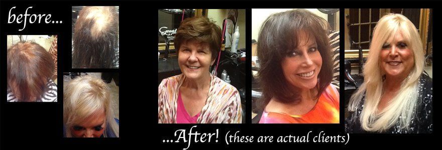 Thin Hair Options
